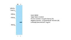 SLC4A3 Rabbit anti-Human, Polyclonal, Novus Biologicals 0.1ml; Unconjugated:Antibodies,